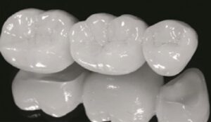کشف و ضبط ۳ هزار عدد کامپوزیت دندانپزشکی غیر مجاز در ارومیه
